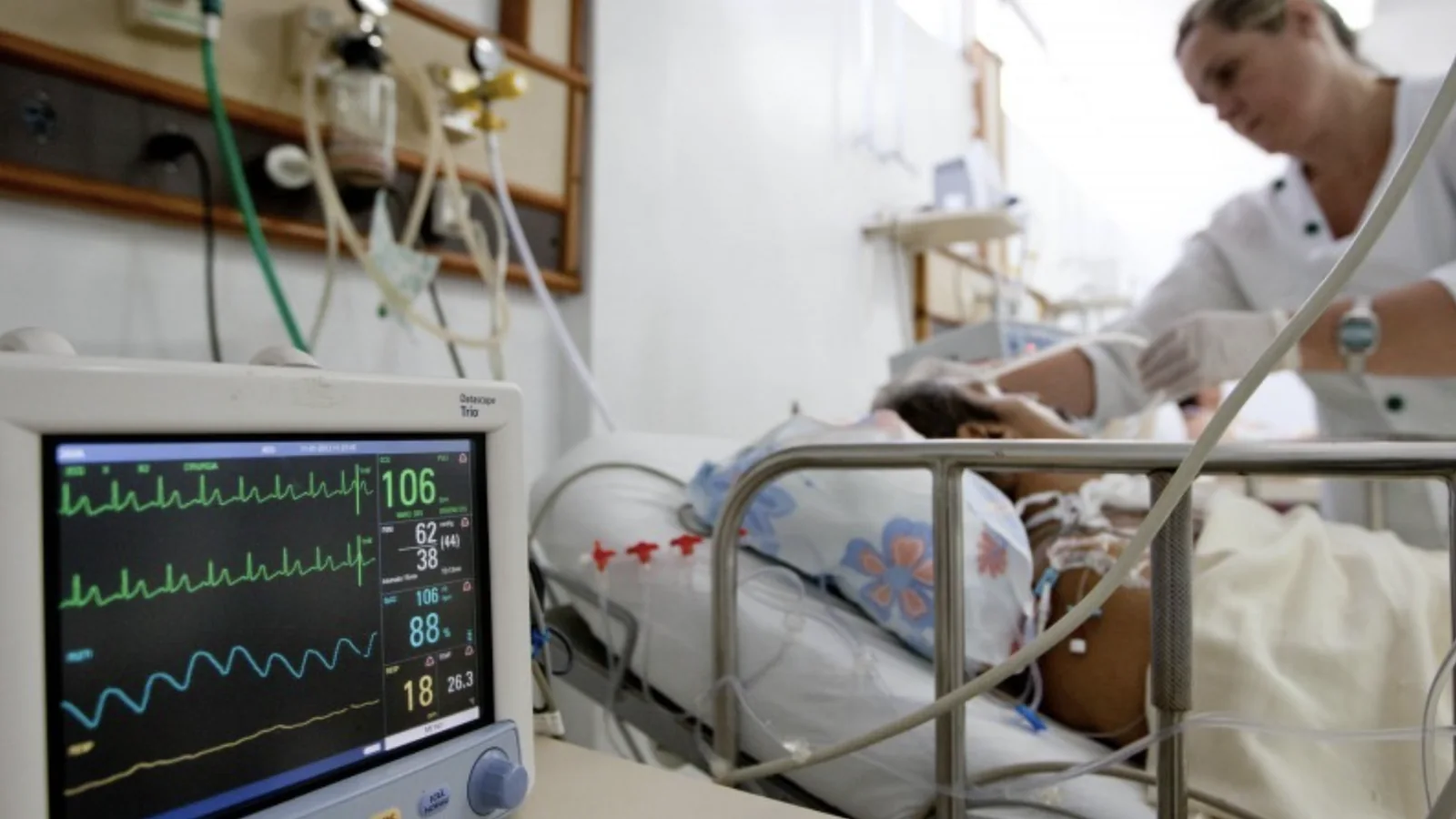 Monitor hospitalar ao lado de paciente em atendimento
